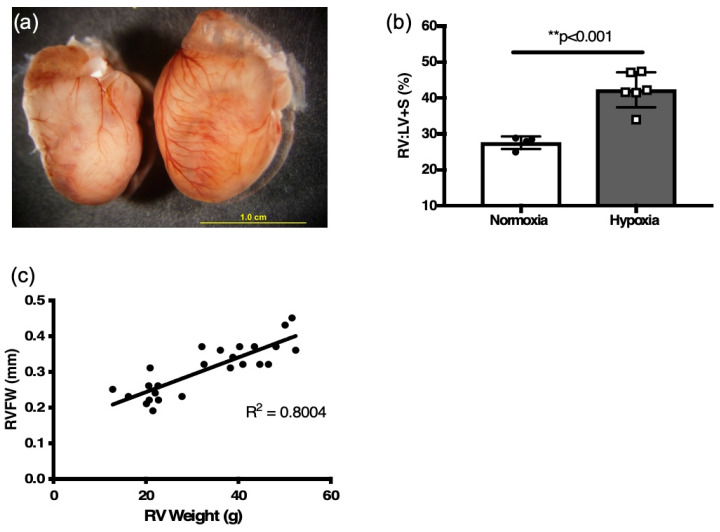 Echocardiographic Assessment of Pulmonary Hemodynamics and Right Ventricular Performance in Neonatal Murine Hypoxia.
