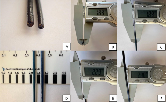 Feasibility and safety of 6.3 Fr vs. 7.5 Fr digital disposable ureteroscopes in retrograde intrarenal surgery: a prospective randomised trial.