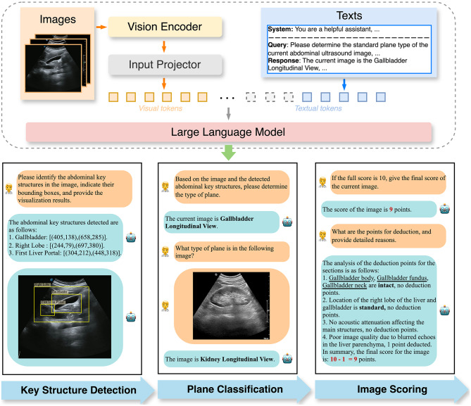 AbVLM-Q: intelligent quality assessment for abdominal ultrasound standard planes via vision-language modeling.