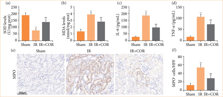 Corynoline alleviates renal ischemia-reperfusion injury by enhancing Nrf2/HO-1 pathway.