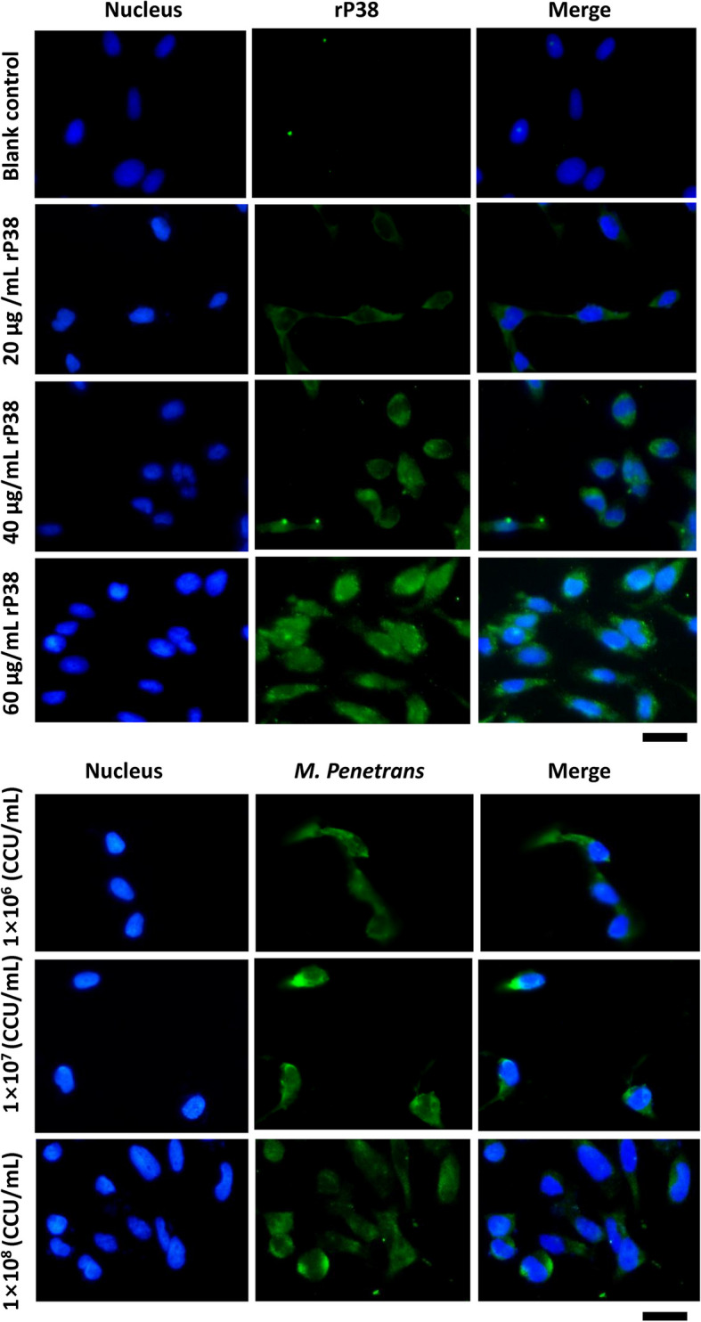 Role of P38 lipoprotein in Mycoplasma penetrans adhesion to human urothelial cells.