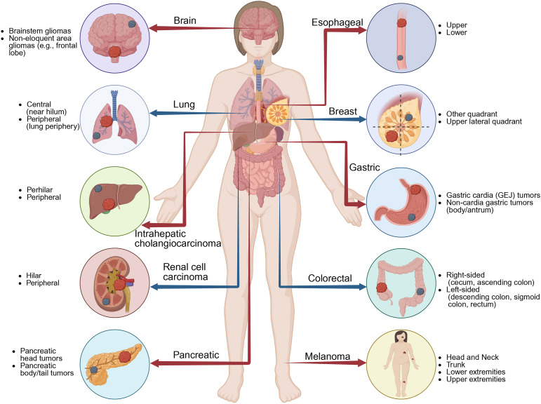 Integrating tumor location into artificial intelligence-based prognostic models in cancer.