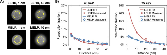 Bridging physics and practice: evaluating sensitivity, septal penetration, and detector dead time in terbium-161 gamma-camera imaging.