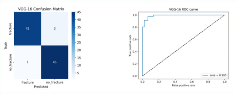 Detection and classification of femoral neck fractures from plain pelvic X-rays using deep learning and machine learning methods.