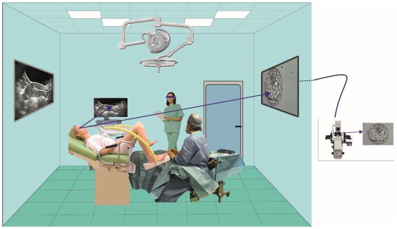 Patient Perceptions of Embryo Visualisation and Ultrasound-Guided Embryo Transfer During IVF: A Descriptive Observational Study.