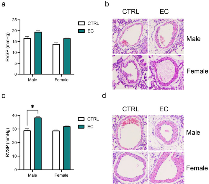 Maternal Electronic Cigarette Exposure Induces Dysregulation of Autophagy via Oxidative Stress/DNA Methylation in Pulmonary Hypertension Offspring.