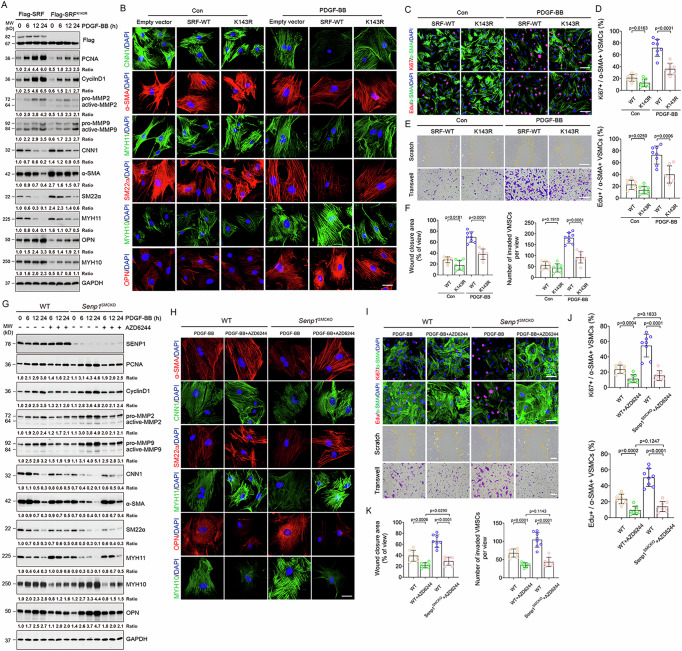 Author Correction: SRF SUMOylation modulates smooth muscle phenotypic switch and vascular remodeling.