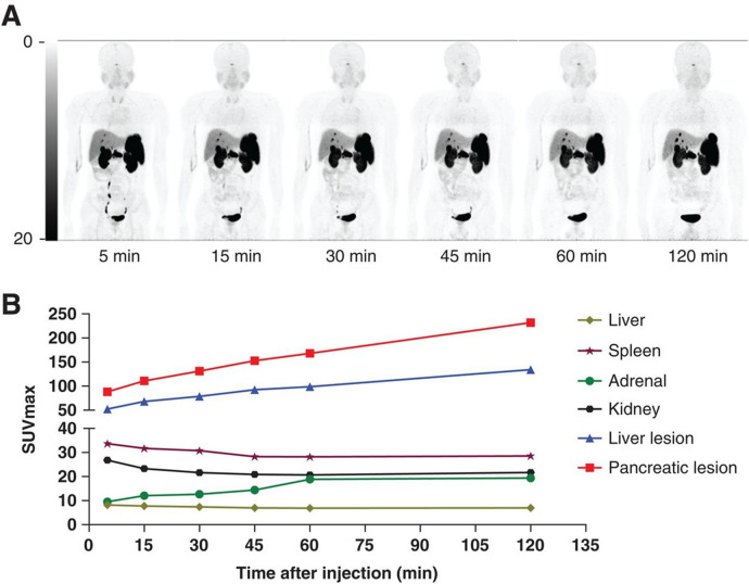 Targeted radionuclide therapy and diagnostic imaging of SSTR positive neuroendocrine tumors: a clinical update in the new decade.