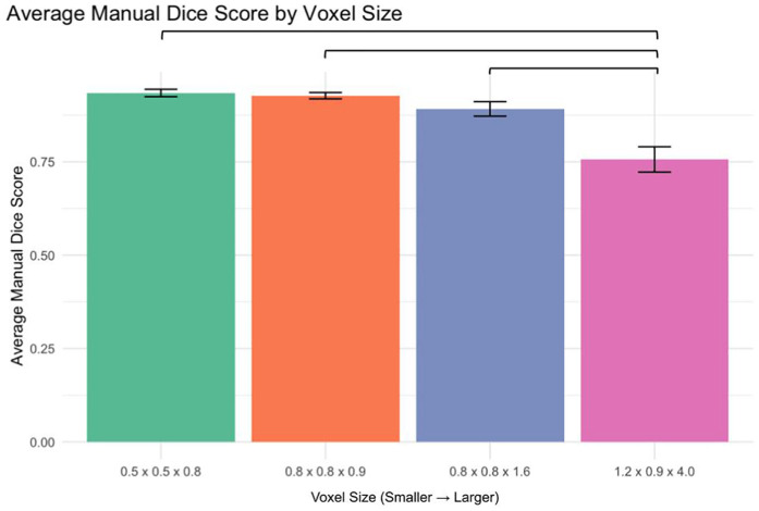 Evaluating the effect of voxel size on the accuracy of 3D volumetric analysis measurements of brain tumors.