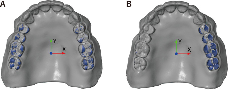 Occlusal teeth surface accuracy of milled complete dentures: a comparison between different manufacturing techniques.