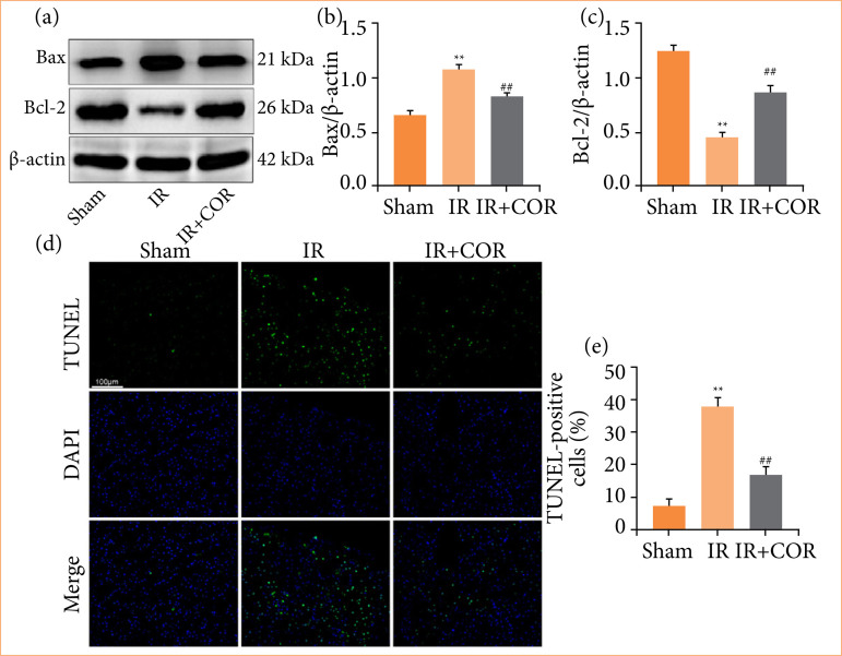 Corynoline alleviates renal ischemia-reperfusion injury by enhancing Nrf2/HO-1 pathway.