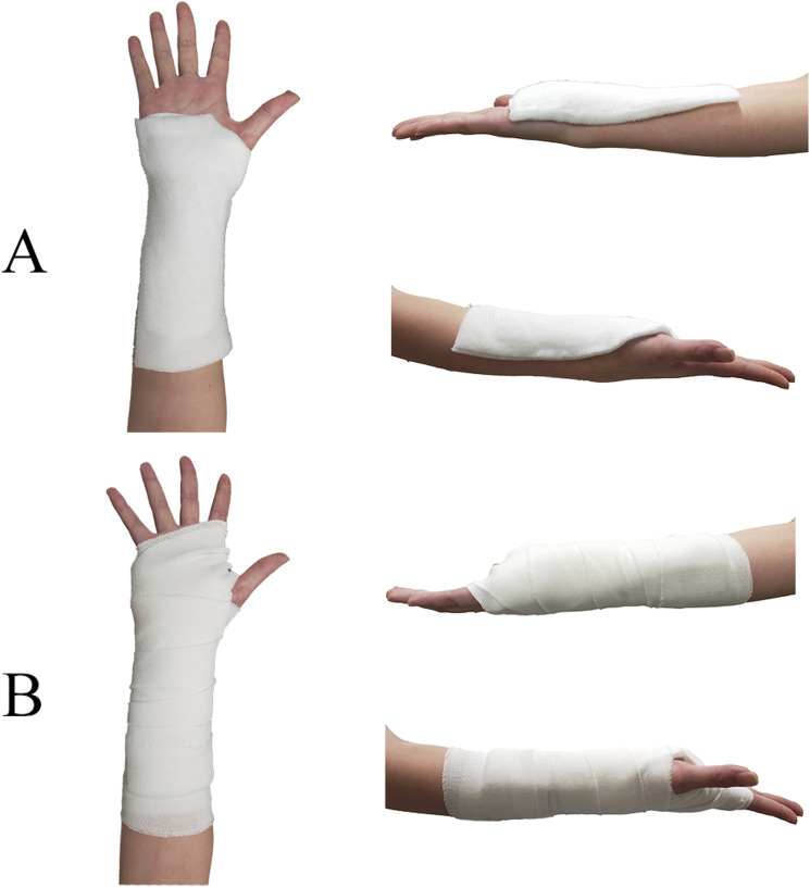 The effects of wrist hand orthosis use on upper limb activity and difficulty in activities of daily living: Influence of material and design differences.