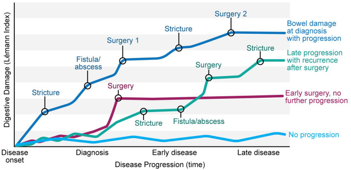 The CROCO (CROhn's Disease COhort Study) - study design and protocol.