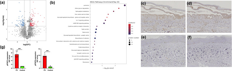 Tofacitinib as a Novel Therapeutic Option for Pemphigus Vulgaris: A Case Report and Mechanistic Insights.