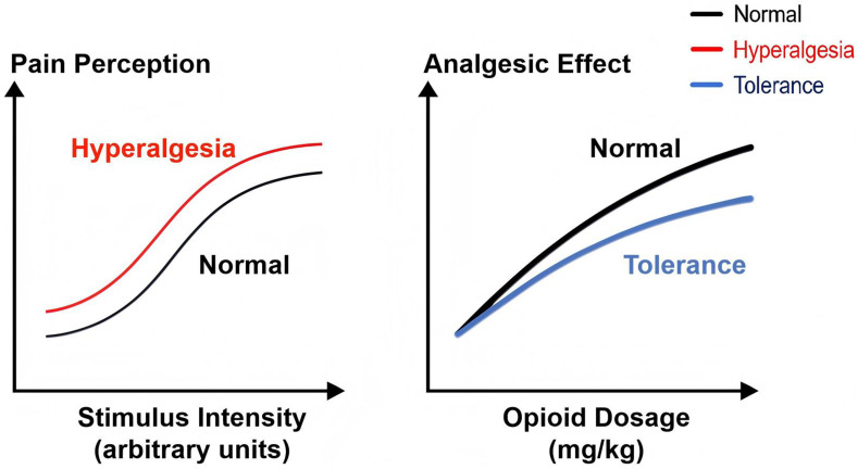 Mechanisms of Remifentanil-Induced Postoperative Hyperalgesia: A Comprehensive Review.