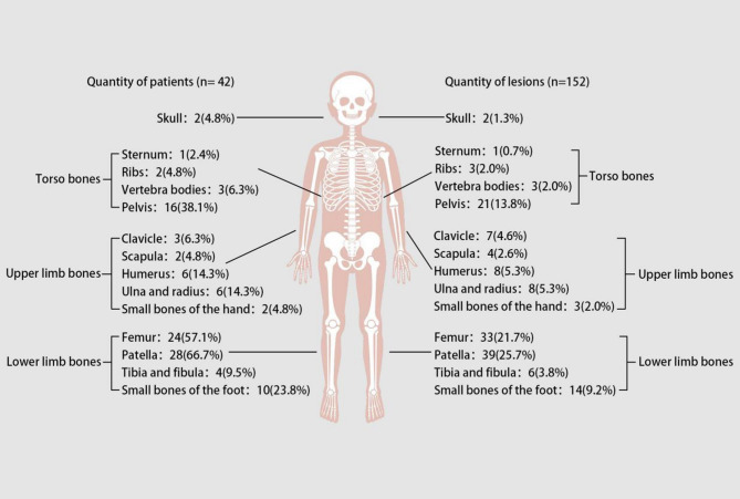 Clinical characteristics and prognosis of patients with chronic recurrent multifocal osteomyelitis based on cluster analysis: a 6-year cohort study.