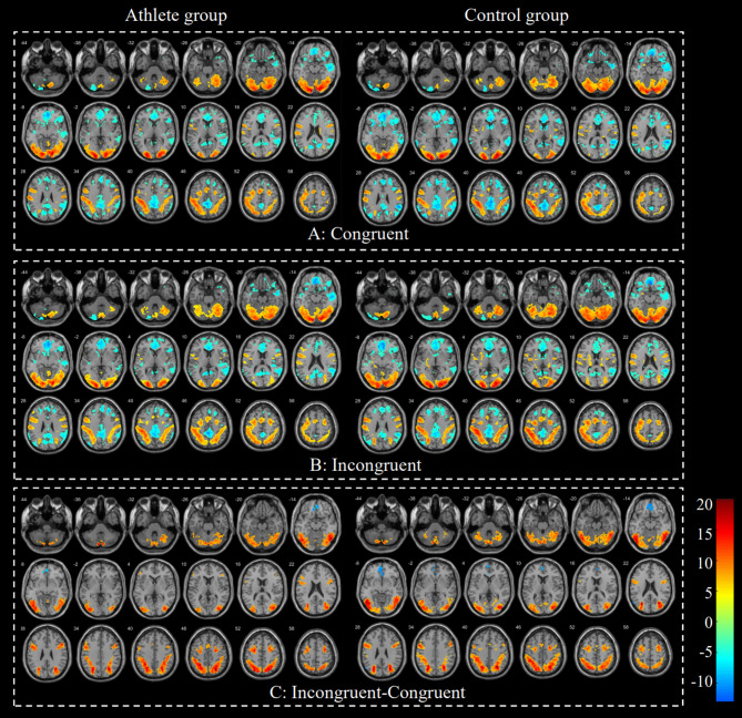 Long-term basketball training shapes cerebellar-frontal integration for enhanced cognitive control.