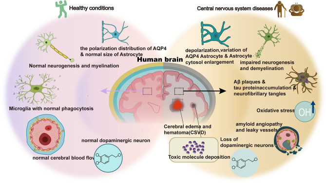 The Cerebral Lymphatic System: Function, Controversies, and Therapeutic Approaches for Central Nervous System Diseases.