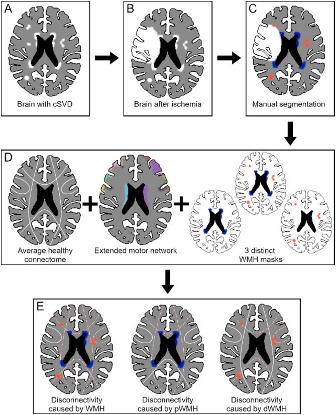 Localized network damage related to white matter hyperintensities is linked to worse outcome after severe stroke.