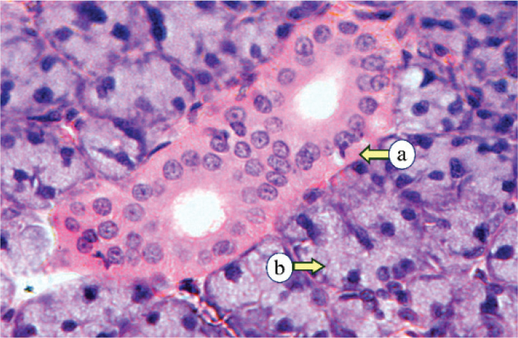 Regenerative potential of the intermediate filaments of albino rat parotid glands subjected to fractionated radiotherapy: an immunohistochemical analysis.
