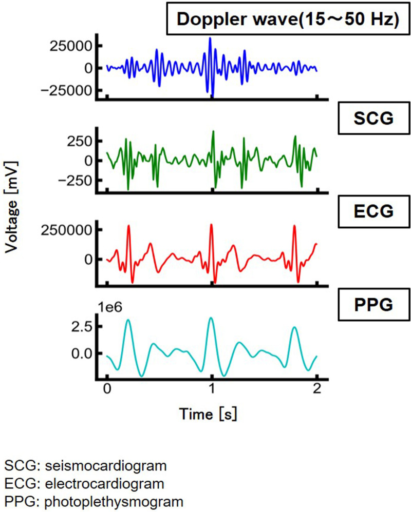 Heartbeat detection and personal authentication using a 60 GHz Doppler sensor.