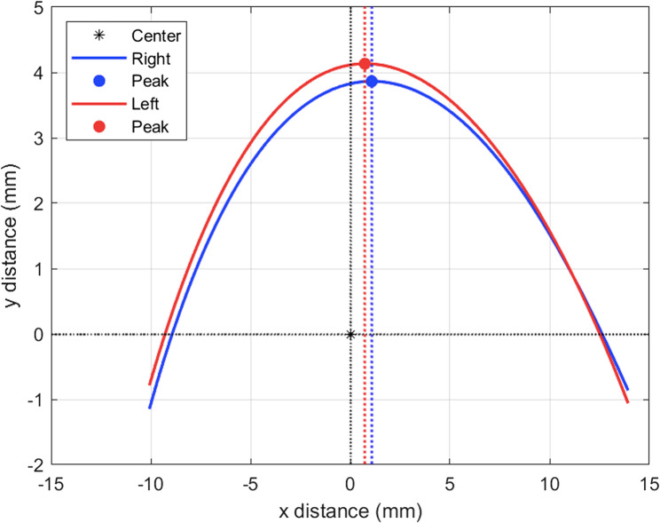 Comparison of eyelid contour symmetry after ptosis repair via centralized versus temporally biased levator suturing techniques.