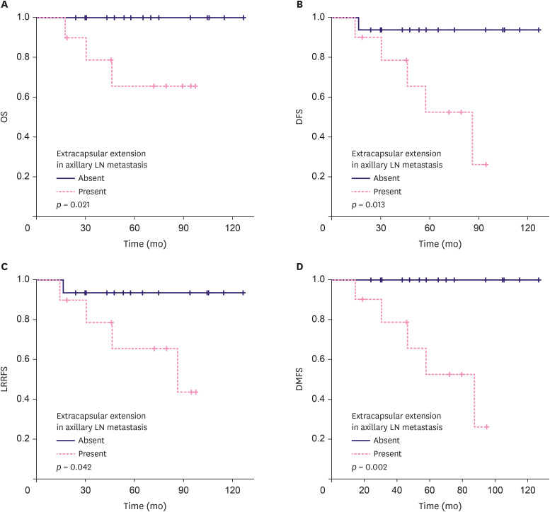 Radiotherapy Boost to Clinically Positive Internal Mammary Lymph Nodes: An Effective Non-Surgical Alternative?