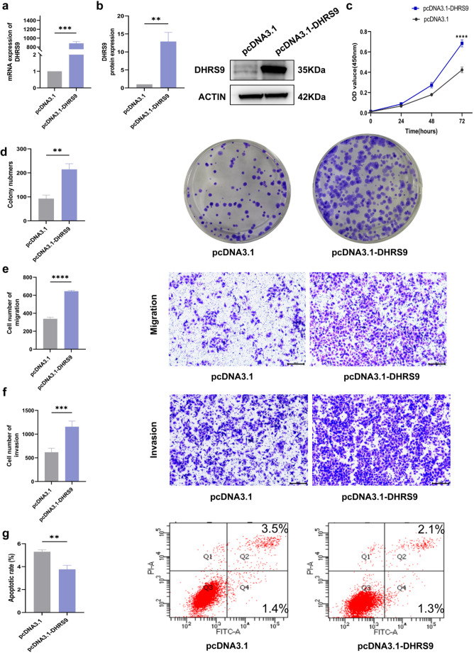 DHRS9 promotes malignant progression of ovarian cancer through SQSTM1.