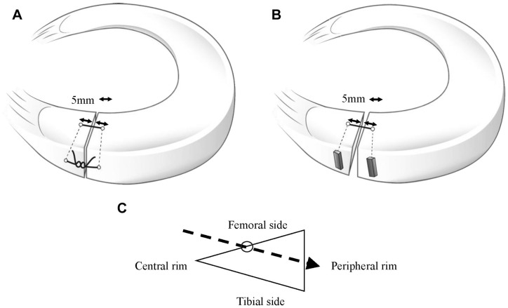 Inside-Out Repair Technique Results in Less Medial Meniscal Extrusion Than All-Inside Repair Technique for Complete Radial Tears of the Medial Meniscus Posterior Segment: A Cadaveric Study.