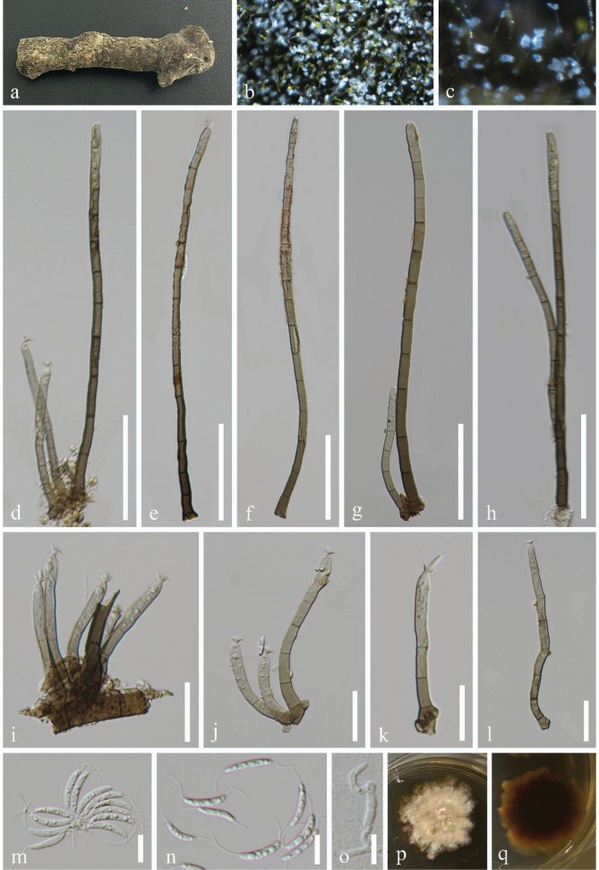 ﻿Two new species of <i>Stilbochaeta</i> (Chaetosphaeriaceae, Chaetosphaeriales) from freshwater and terrestrial habitats in China.