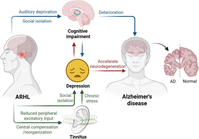 Pathophysiological insights and therapeutic developments in age-related hearing loss: a narrative review.