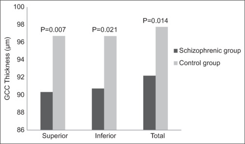 Effects of schizophrenia on retina.