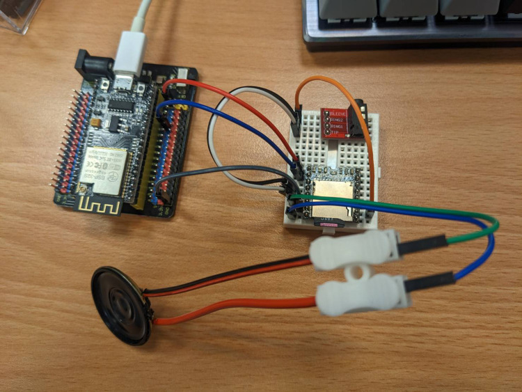 An AIoT-Based Home Monitoring System for Arteriovenous Fistula Surveillance in Hemodialysis Patients: Development, Evaluation, and Clinical Potential.