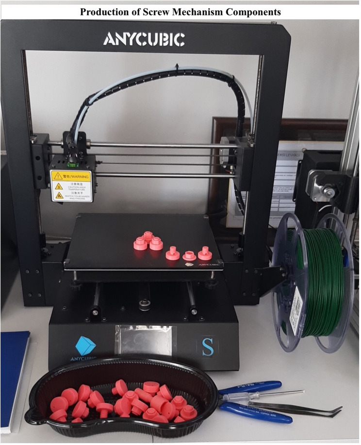 A 3D-printed screw mechanism as an alternative method to prevent wire migration in nonpalpable breast lesion localization.