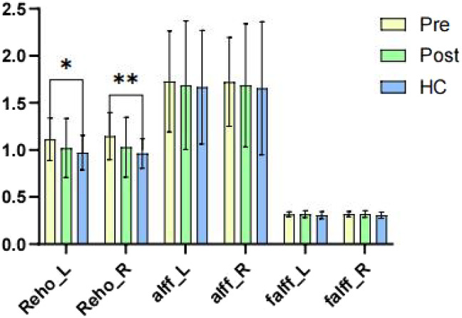 Exploring Facial Nucleus-Centered Connectivity in Hemifacial Spasm: Novel Insights into Pathogenesis and Surgical Impact.