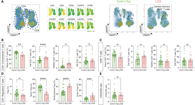 Distinct T Cell Dysregulation Reflects Disease Severity and Progression in Infantile Epileptic Spasms Syndrome and Lennox-Gastaut Syndrome.