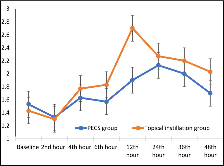 Could Wound Instillation Provide an Efficient Analgesia Comparable to That Provided by PECS-II Block for Modified Radical Mastectomy Using Ketamine-Bupivacaine Combination? A Pilot Study.