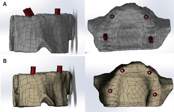 <i>In vitro</i> evaluation of the effect of auxiliary geometric device on measurement trueness and scanning time in full-arch implant impressions.