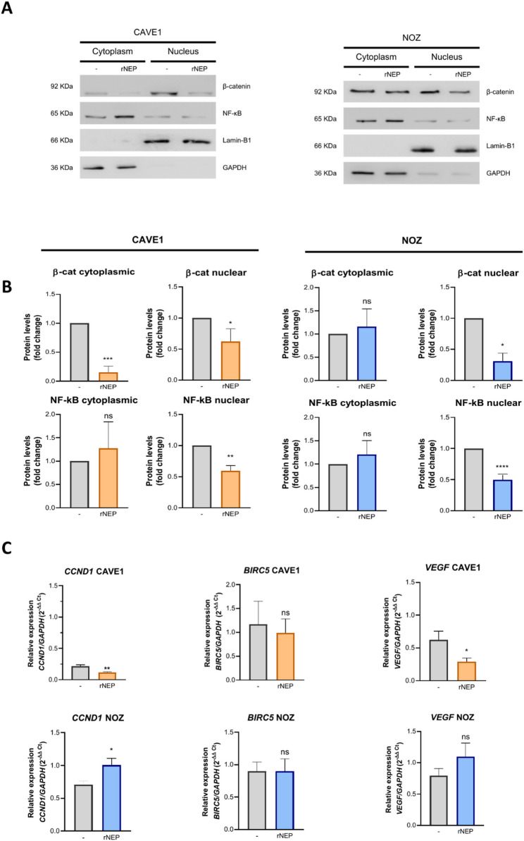 Decreased Endothelin-1 bioavailability impairs aggressiveness of gallbladder cancer cells.