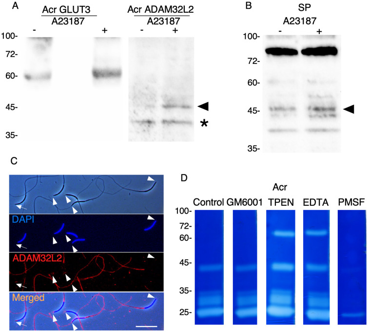 Expression, Localization, and Processing of Chicken Sperm ADAM32L2 during the Acrosome Reaction: A Possible Function in the Sperm-Egg Interaction.