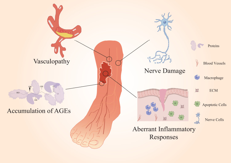 Exosomes in Diabetic Wound Healing: Mechanisms, Applications, and Perspectives.