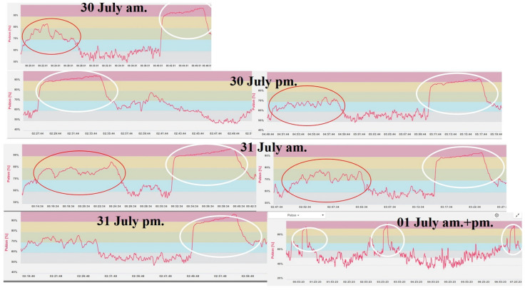 A Pilot Study of the Effect of Locomotor and Mechanical Loads on Elite Rowers During Competition Days.