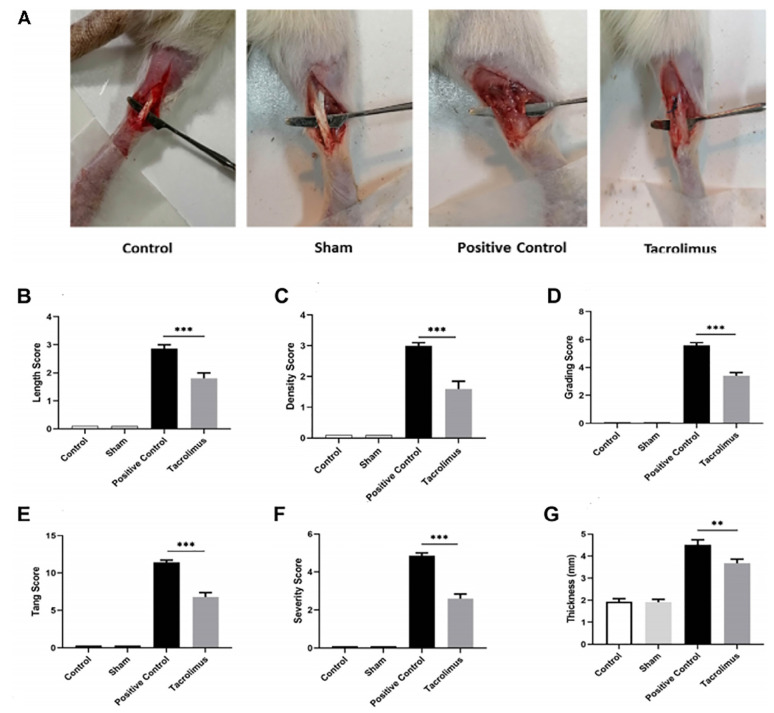 Anti-Fibrotic Effect of Tacrolimus on Preventing Adhesion after Achilles Tendon Surgery in a Murine Model.