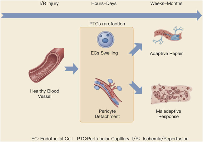 Molecular mechanisms and therapeutic advances of peritubular capillary neogenesis in acute kidney injury.