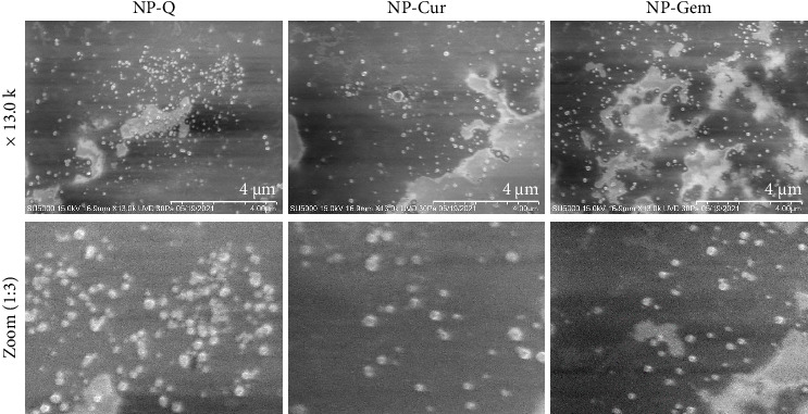 Encapsulation of Curcumin and Gemcitabine: Cytotoxic Effect and Mechanisms of Death in Lung Cancer.