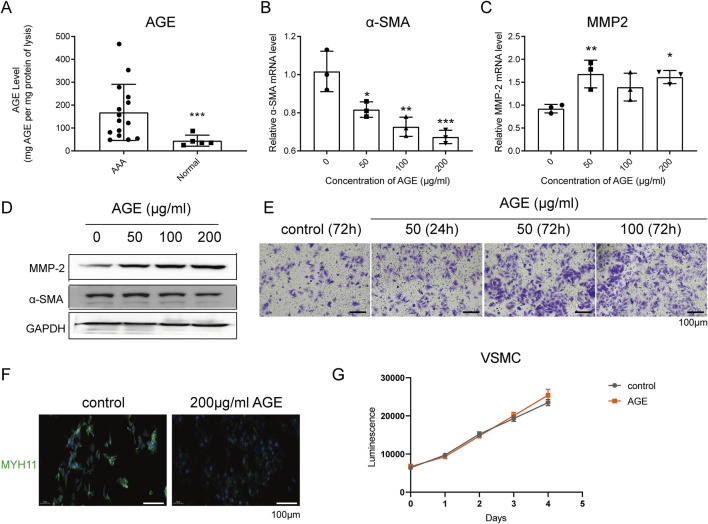 Mechanisms of AGE-induced VSMC phenotypic switching and macrophage modulation in human abdominal aortic aneurysms.