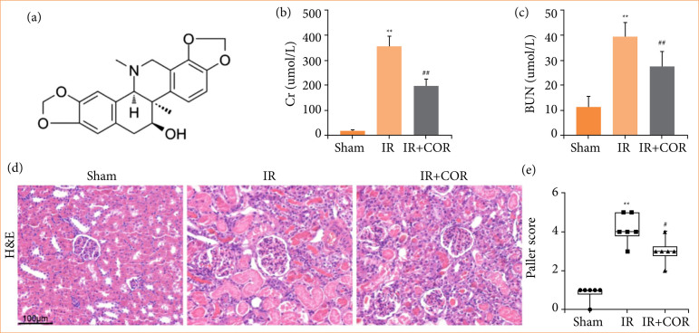 Corynoline alleviates renal ischemia-reperfusion injury by enhancing Nrf2/HO-1 pathway.
