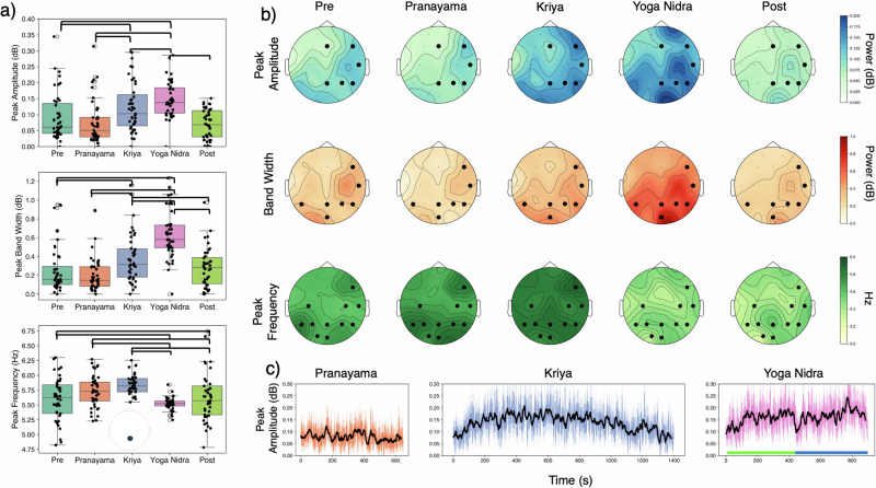 Unlocking deep relaxation: the power of rhythmic breathing on brain rhythms.