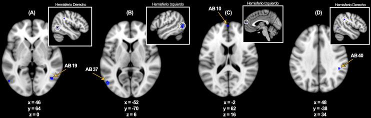 [Study of Successful Emotional Memory Encoding with Functional Magnetic Resonance Imaging: A Meta-Analysis Comparing the Affective Salience of Words Versus Images].