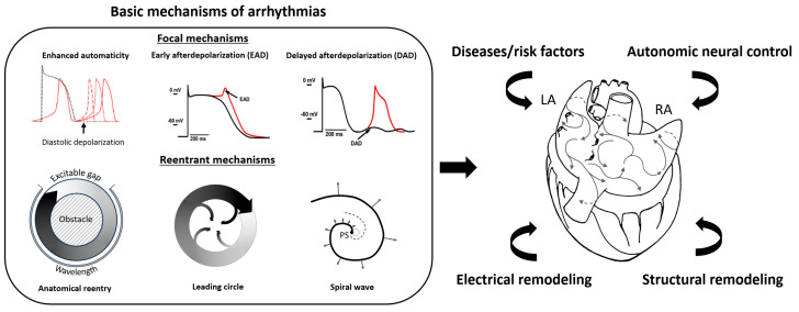 Hybrid Ablation in Atrial Fibrillation: Bridging Mechanistic Understanding and Clinical Practice.